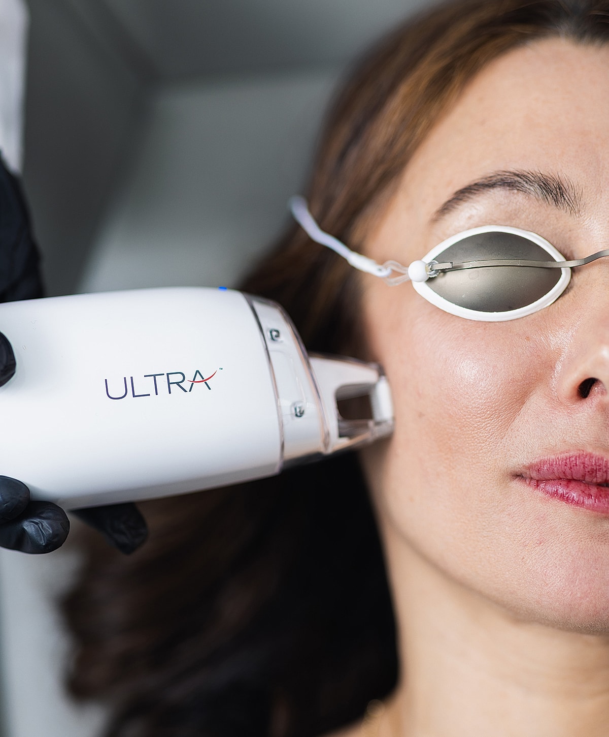 Woman receiving laser treatment on her face