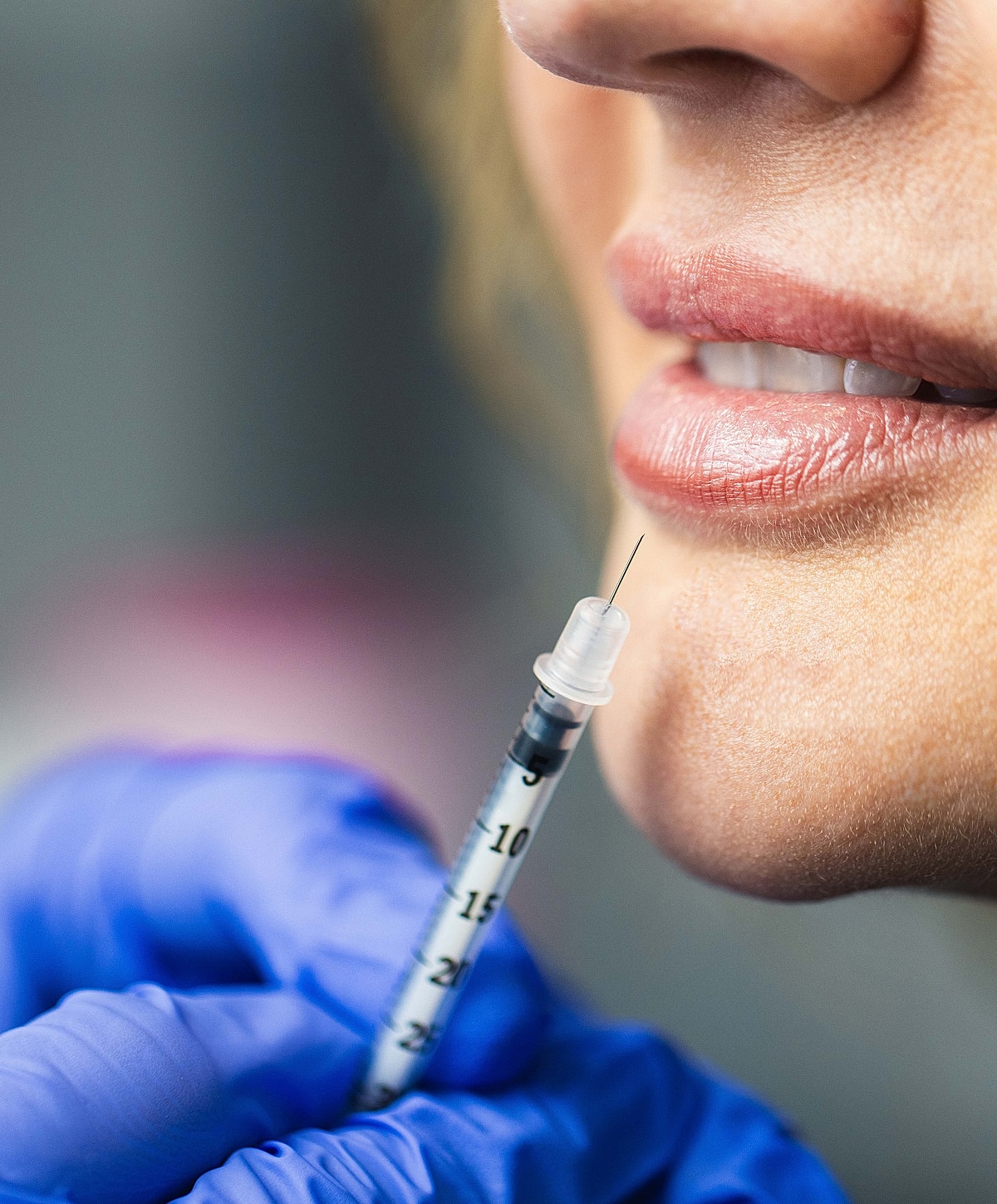 Syringe preparing for facial treatment or injection.