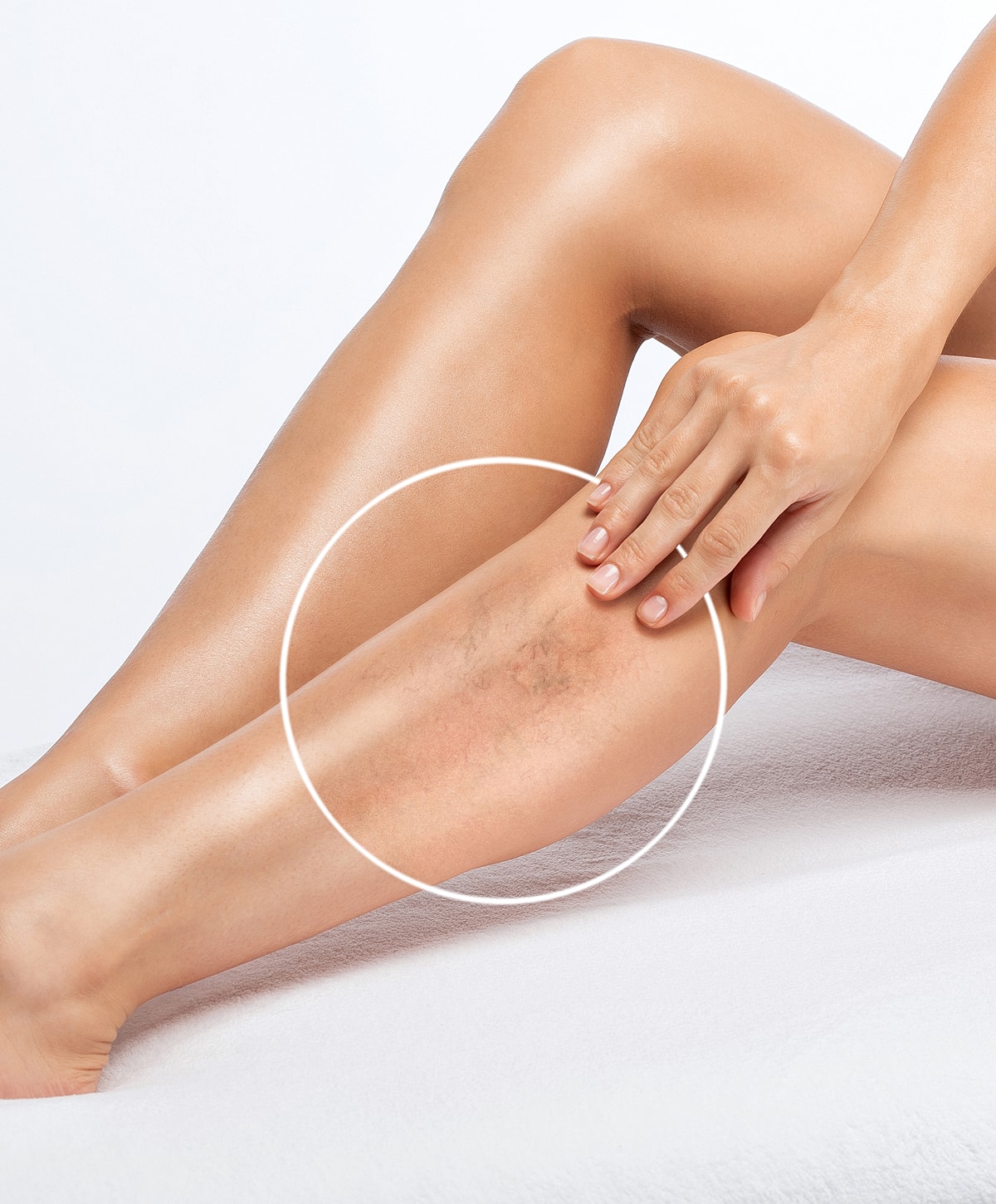 Woman's hand touching leg with skin imperfections.