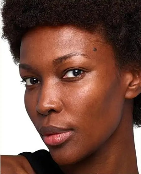 Before and After SKINVIVE