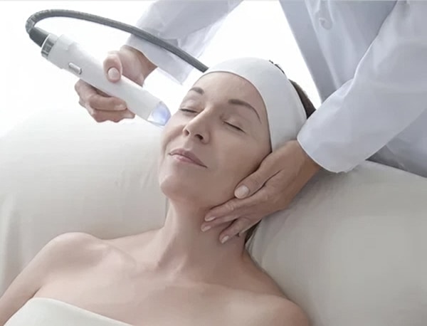 Vivace Microneedling