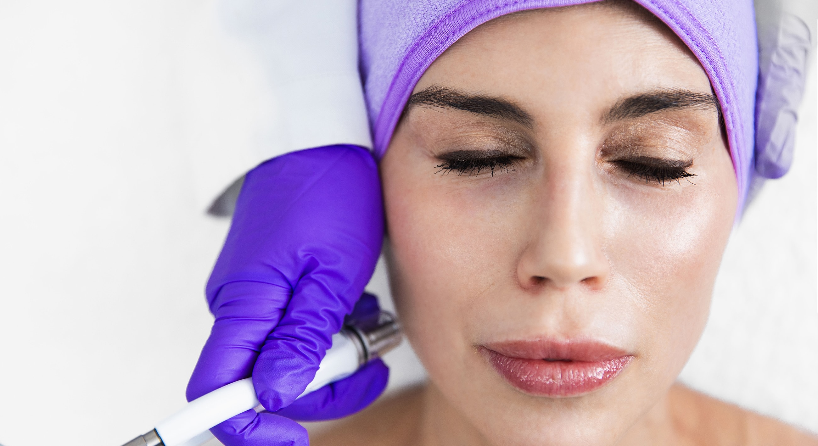 Woman receiving facial treatment with microneedling device.