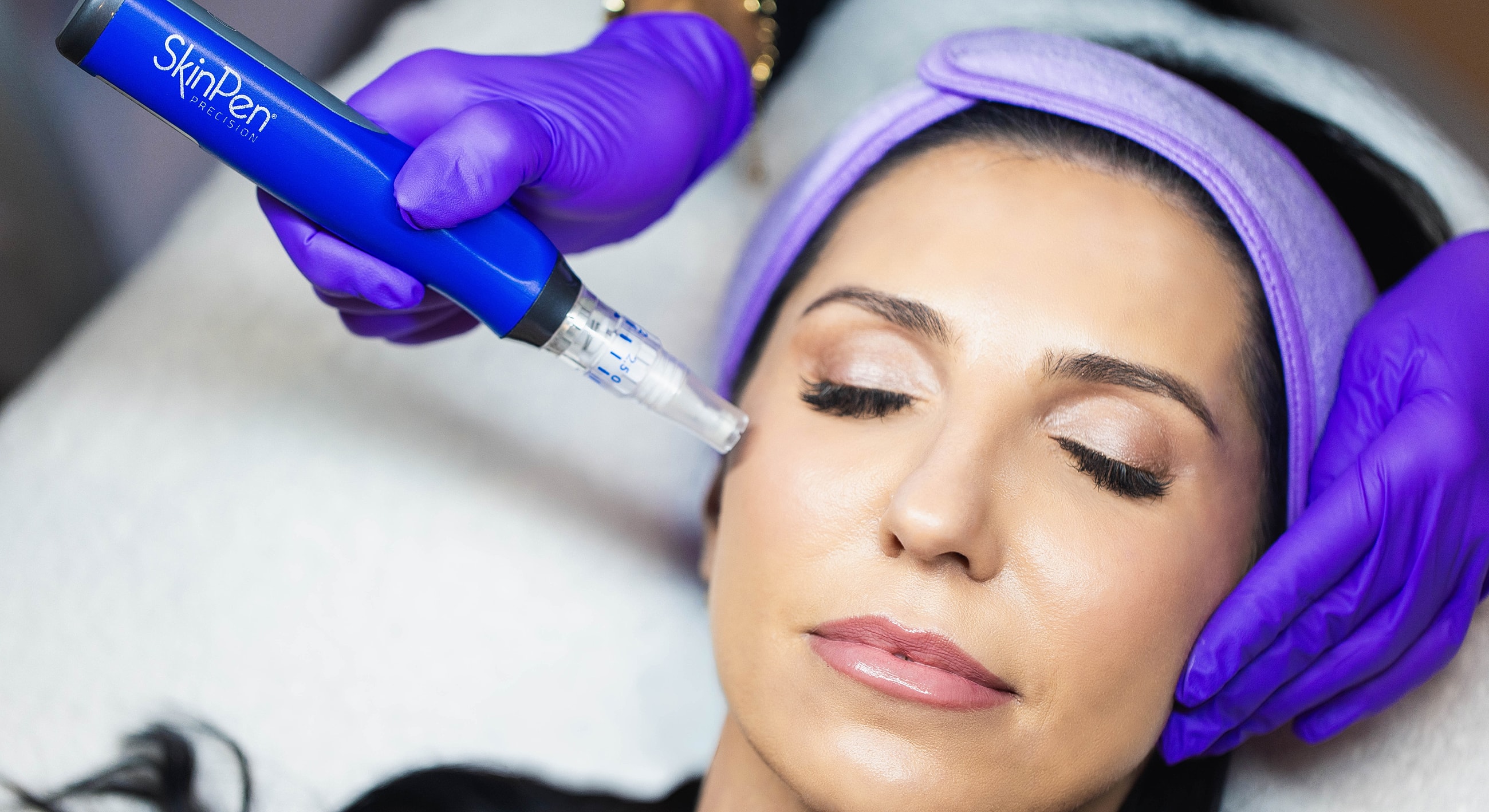Microneedling treatment in progress on a client's face.
